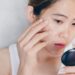 Skincare untuk Jerawat Hormon