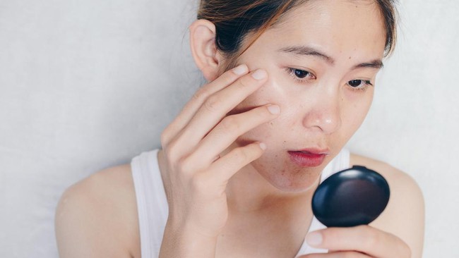 Skincare untuk Jerawat Hormon