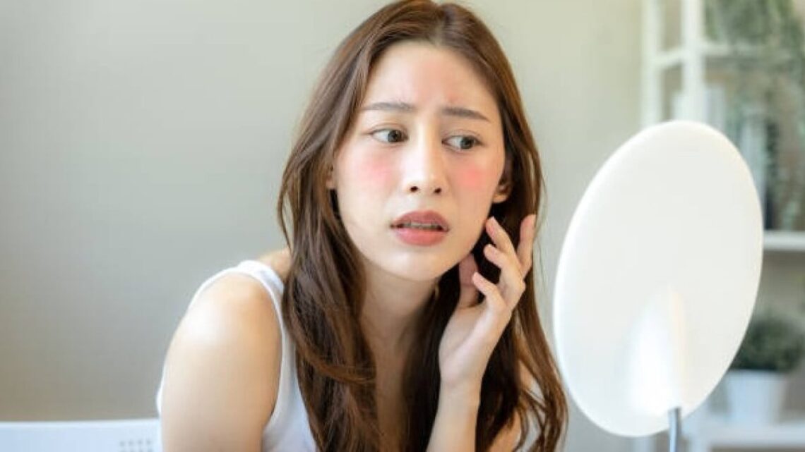 Skincare untuk Jerawat Meradang